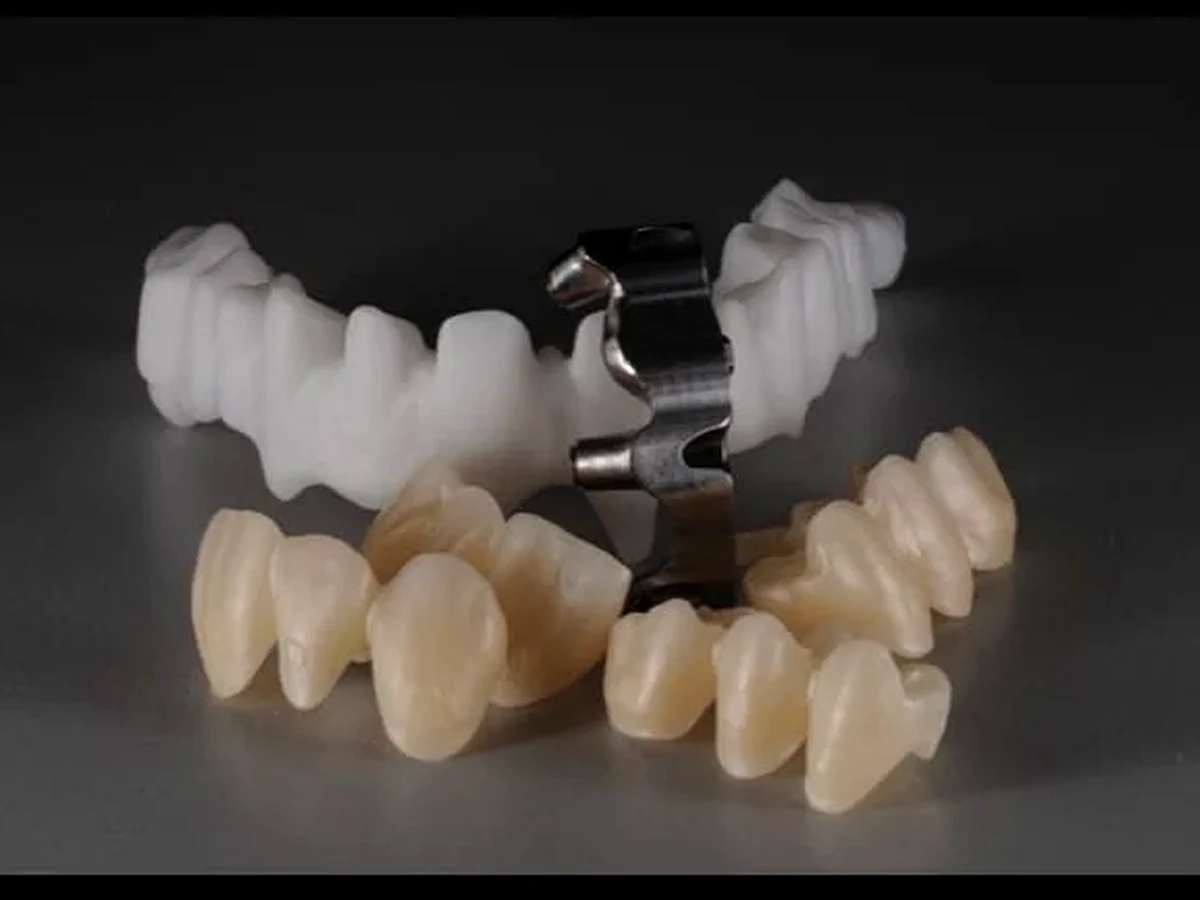 Lavorazione odontotecnica DTW
