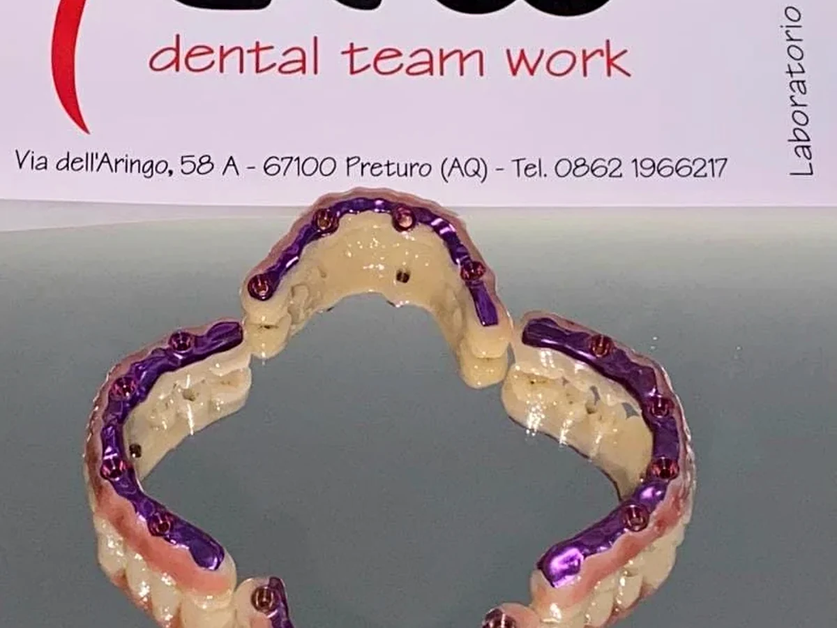 Lavorazione odontotecnica DTW